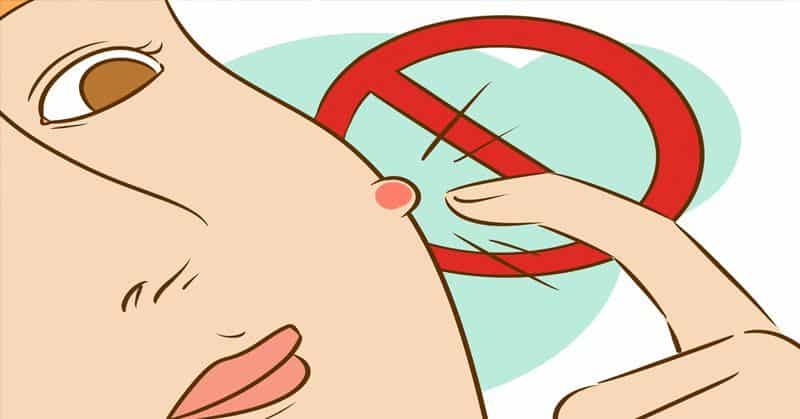 Postupujte podle těchto 4 jednoduchých kroků, abyste už nemuseli nikdy řešit problémy s akné.