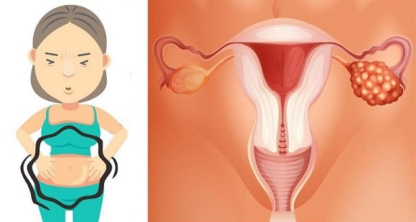 4 nejčastější příznaky rakoviny vaječníků, které by měla znát každá žena. Znáte je i vy?