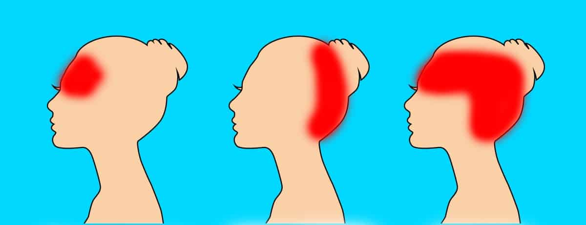 Na bolest hlavy pomůže i stimulace správných bodů na těle