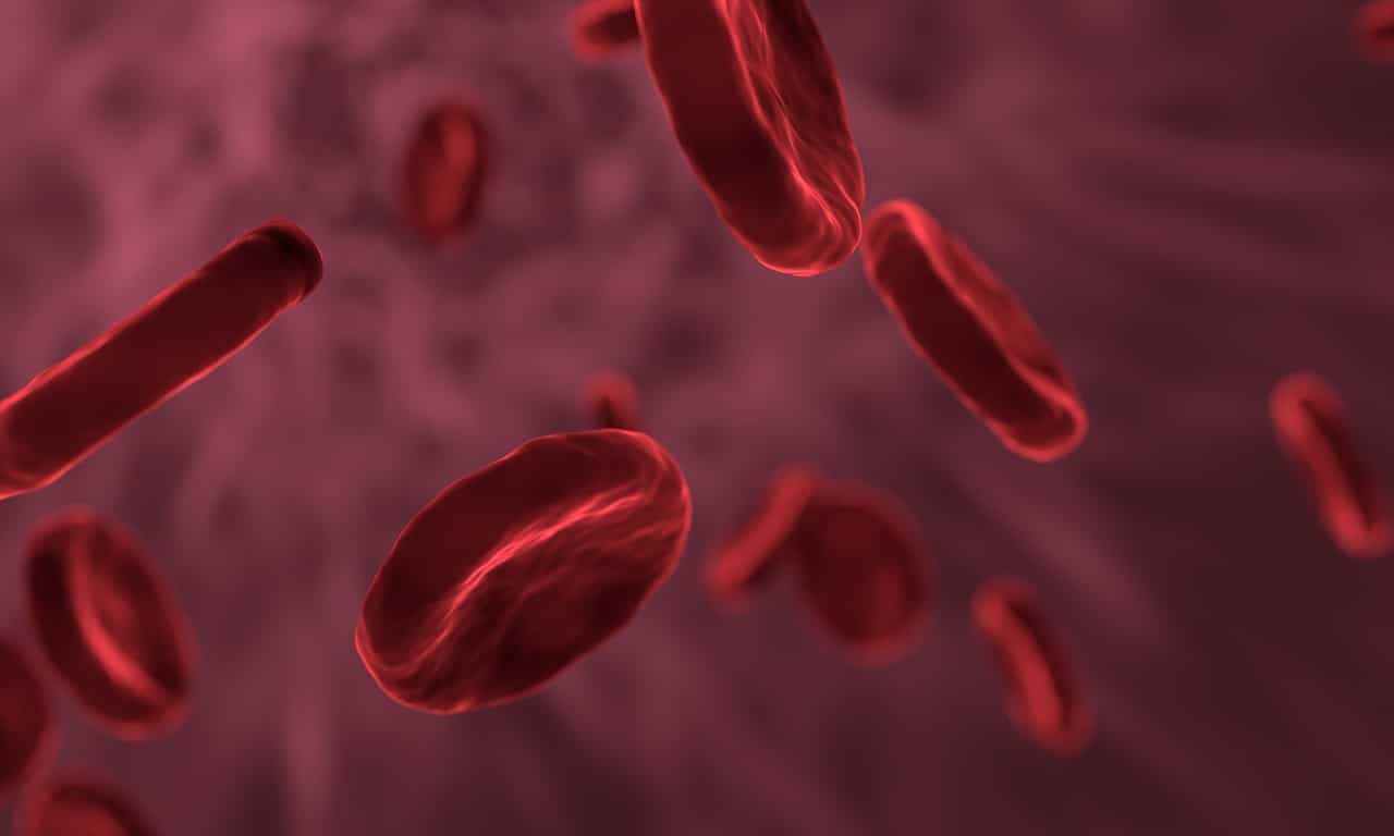 Nebezpečná krevní sraženina a jak ji včas rozpoznat