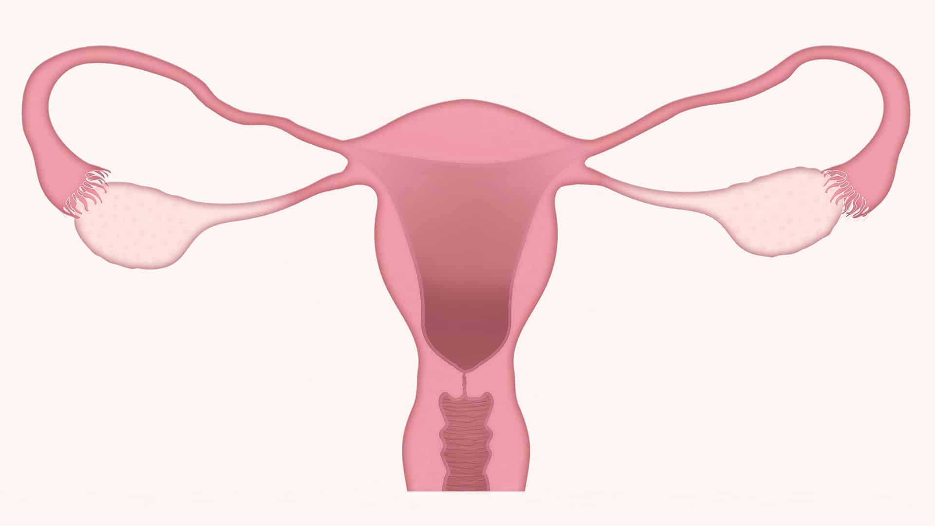 Ženy, znáte 5 příznaků rakoviny vaječníků?
