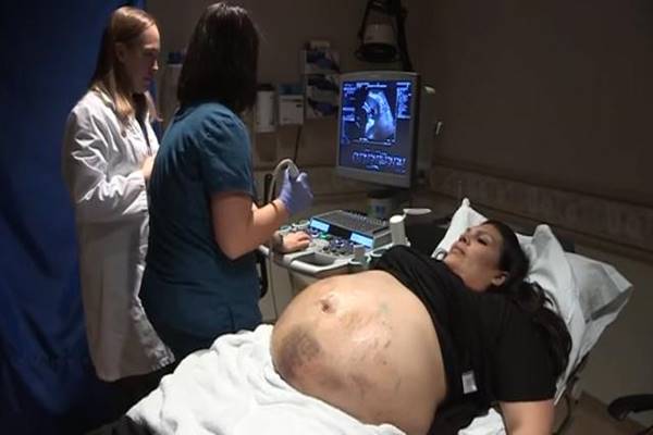 Muž a žena očekávali jednoho potomka. Ultrazvuk však překvapil i samotného lékaře