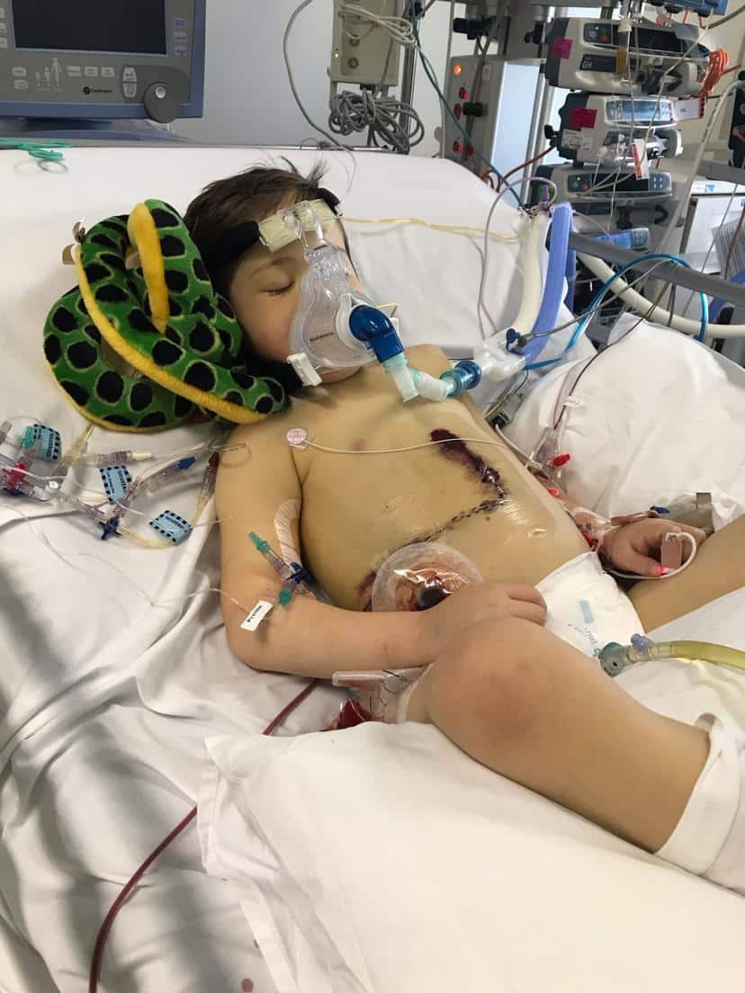 Unikátní transplantace jater zachránila život malého chlapce