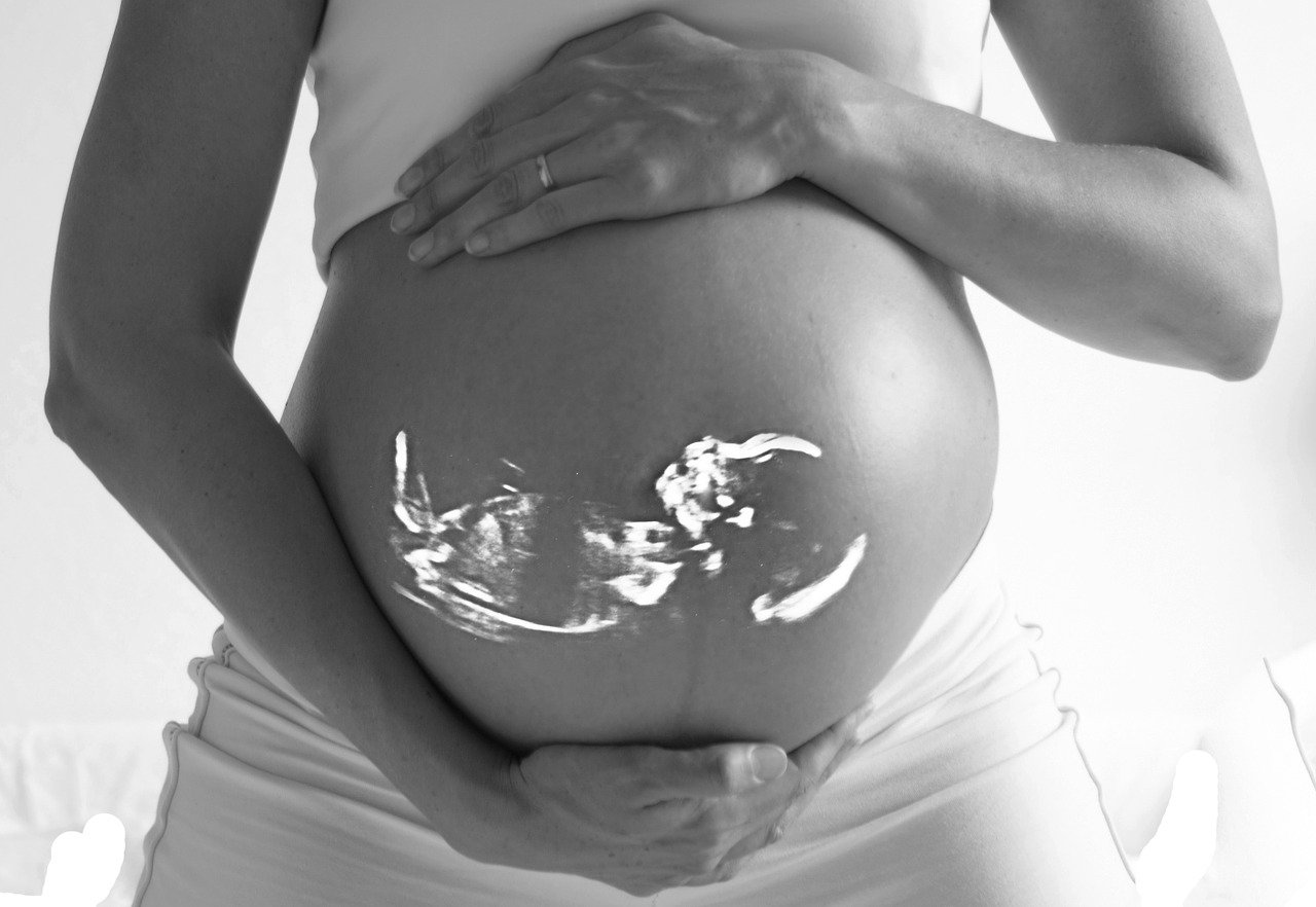 Vlásky malého miminka byly vidět i na ultrazvuku
