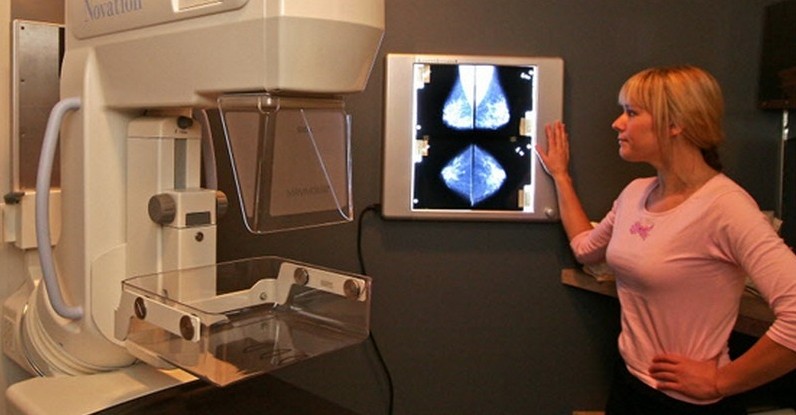 Mamografie: Průkopnický výzkum a jeho dopady na veřejné zdraví