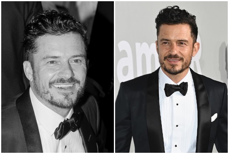 Slavný herec Orlando Bloom měl v dětství děsivou nehodu! Zlomil si páteř a málem skončil na vozíku!