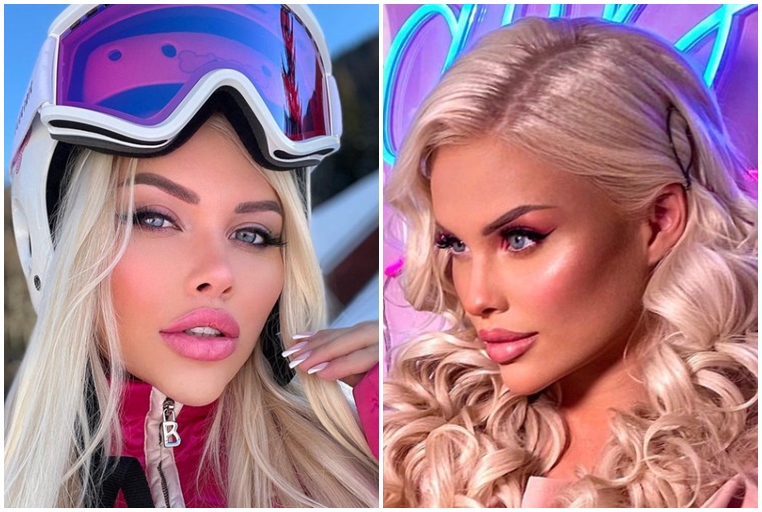 Česká Barbie Gabriela Jiráčková stále nemá dost! Nyní plánuje prodloužení nohou! Nechá si dobrovolně zlomit kosti!