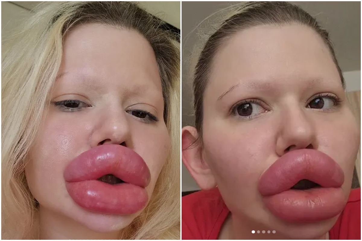 Spousta dívek mi závidí můj vzhled, říká Bulharka s největšími rty Andrea Ivanova! Plánuje další úpravy! Co chystá tentokrát?