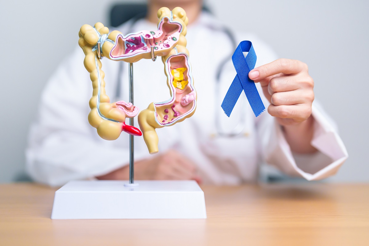 7 málo známých symptomů rakoviny konečníku