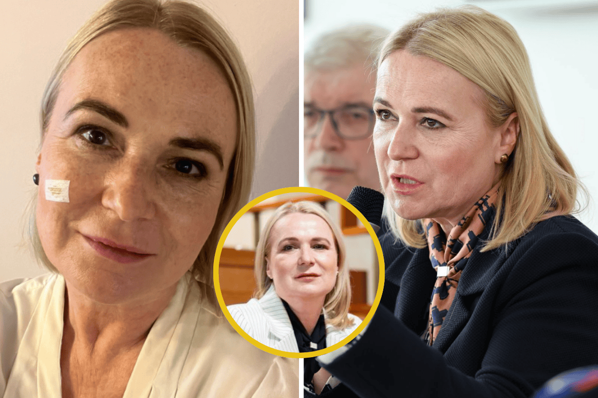 Jana Černochová po odstranění nádoru v obličeji apeluje na veřejnost! Její příběh možná změní i Váš pohled na zdraví!