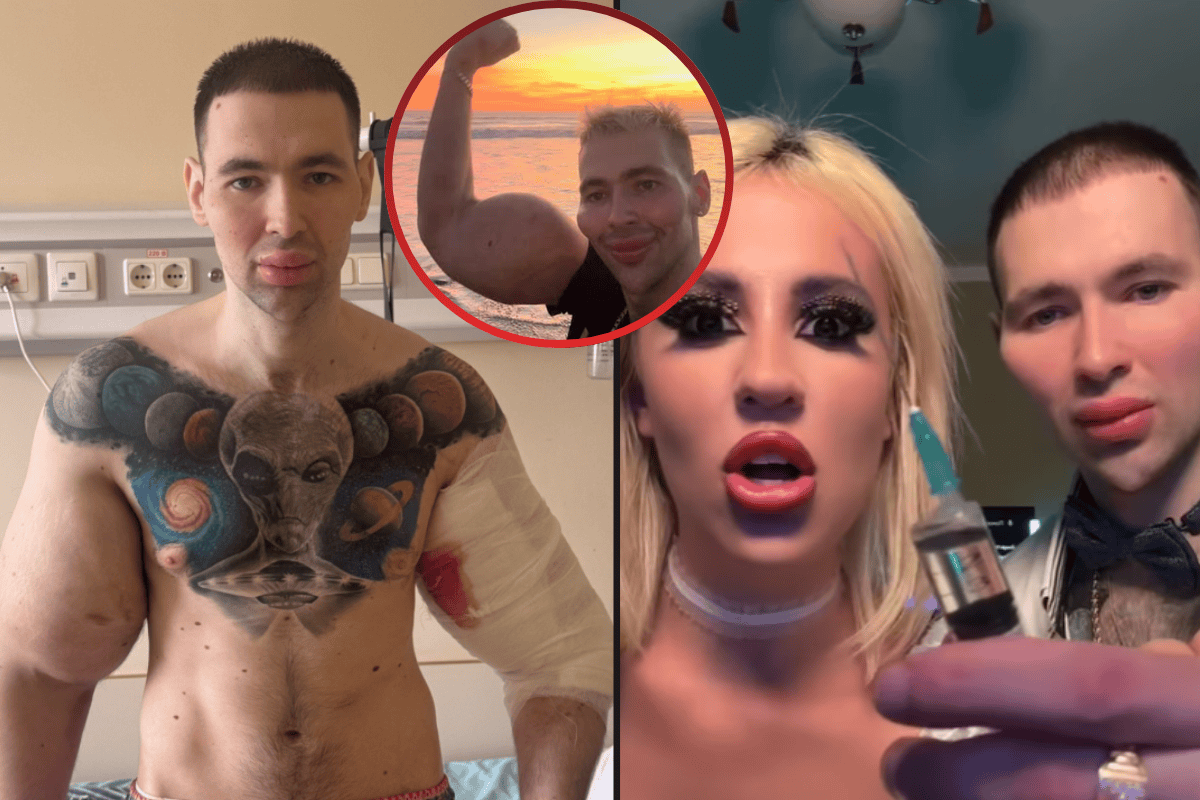 Muž si roky si píchal vazelínu a teď bojuje o ruku! Zachrání Kirill Těrešin svou paži, nebo skončí extrémní experiment amputací?