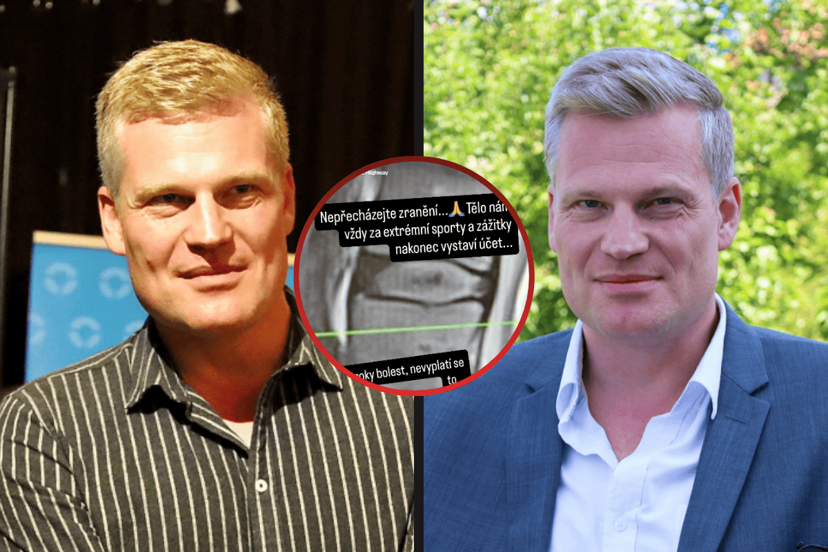 Turek ukázal rentgen a přiznal kruté bolesti! Vyřadily ho z jednání na Hradě! Místo něj dorazil někdo jiný!
