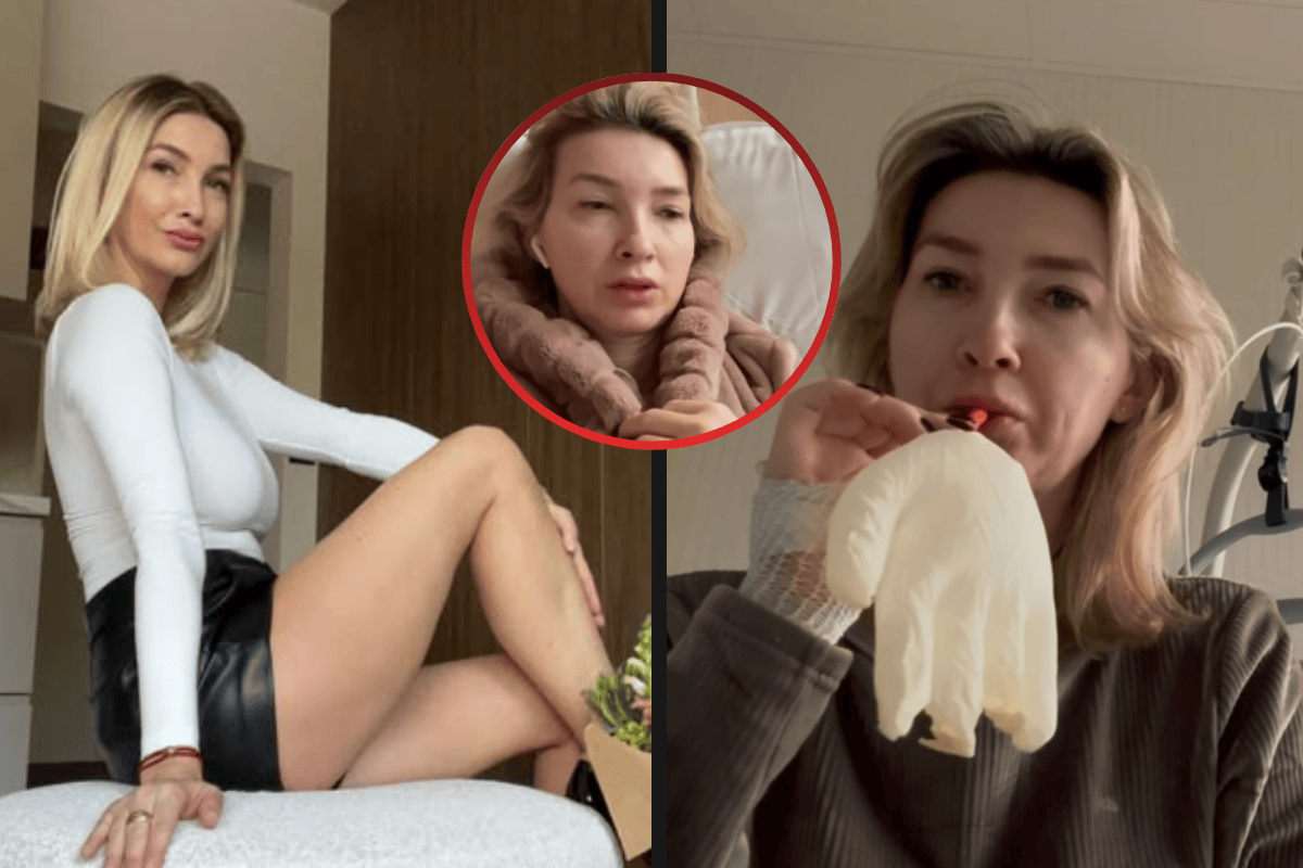 Děsivý omyl během alternativní léčby! Modelka Dominika Mesarošová šokuje přiznáním z nemocnice! Během akupunktury jí propíchli plíci!