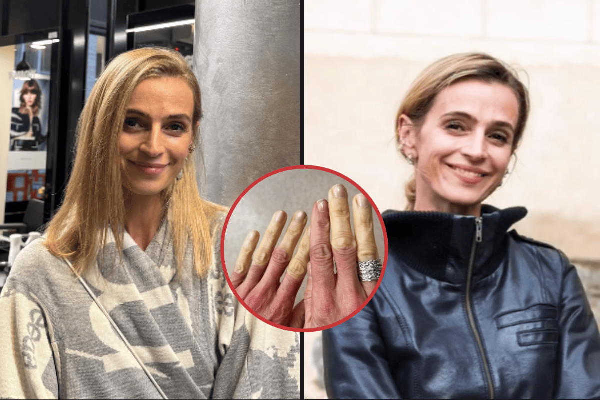 Šokující přiznání Ivany Jirešové! Krutá nemoc jí ničí prsty a na place zažívá chvíle bez citu!