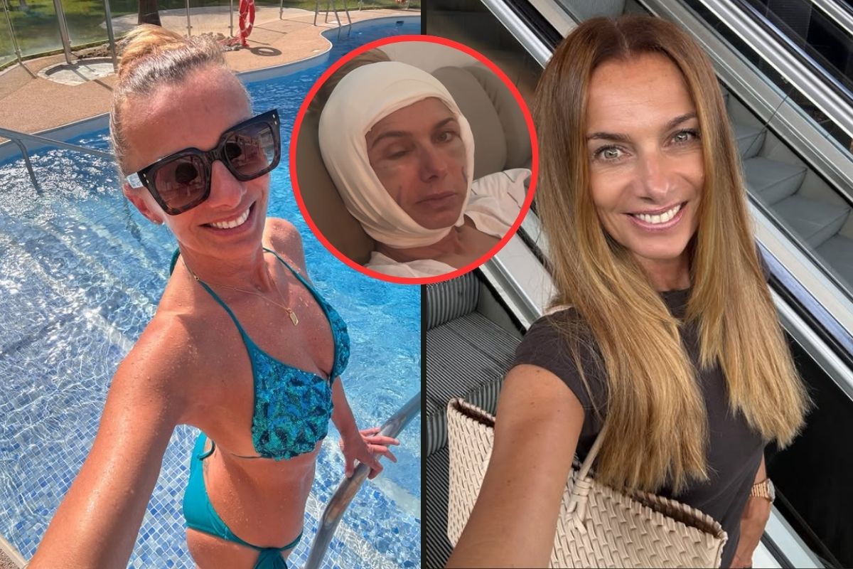 Tohle fanoušci Alice Bendové rozhodně nečekali! Obvazy, modřiny a oteklá tvář vyvolaly dohady, co se moderátorce stalo?