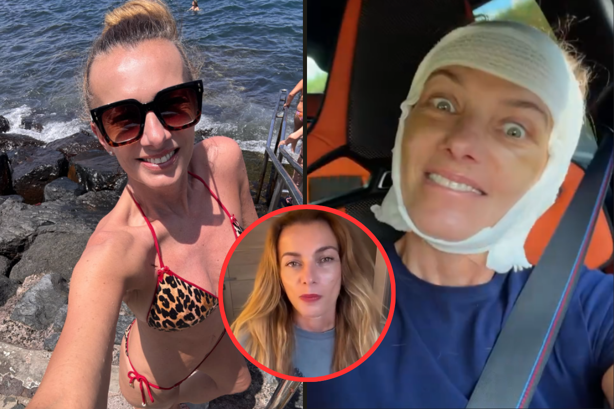 Alice Bendová se ukázala po faceliftu! Jizvy má kolem obličeje i pod krkem! Co na její velkou proměnu říkáte?