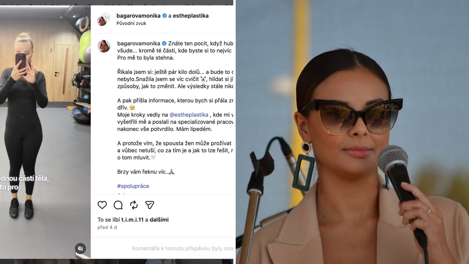 Monika Bagárová trpí lipedémem a přiznala to fanouškům! Zákeřná nemoc postihuje každou desátou ženu a spousta z nich o tom ani neví