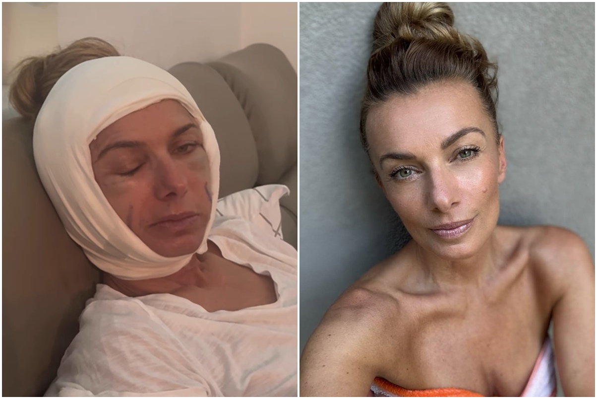 Alice Bendová se rozjela! Po faceliftu přišla s další viditelnou proměnou!